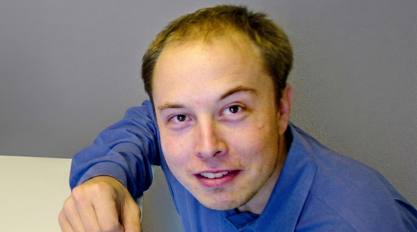 Early 2000s: More Noticeable Hair Loss