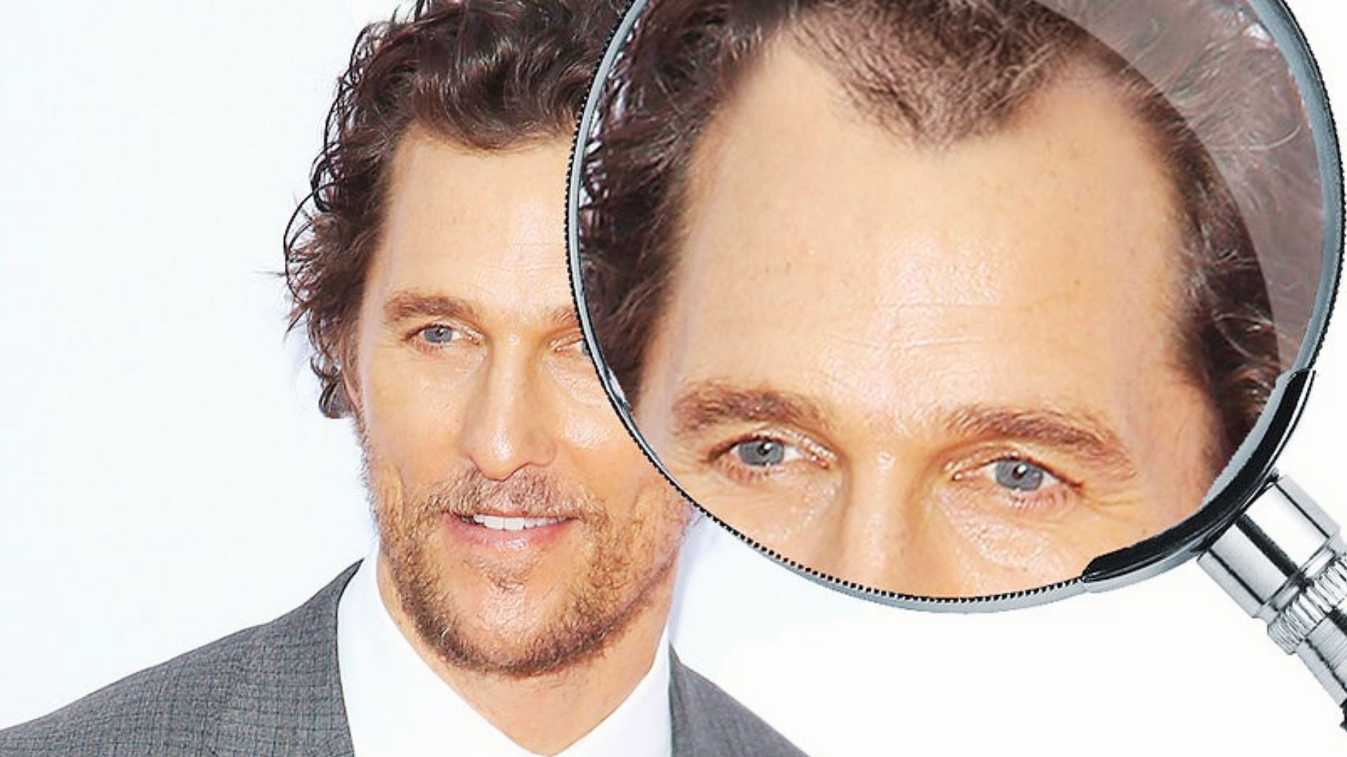 Old photos of Matthew McConaughey showing clear hair thinning and hair loss.