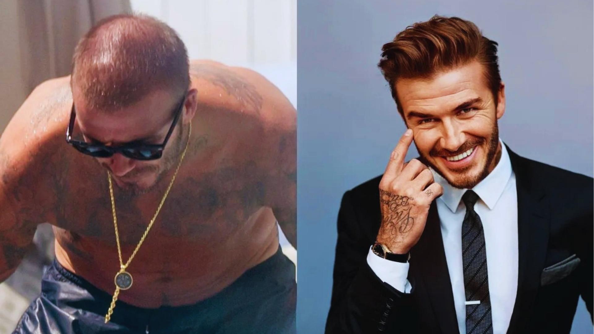 Split comparison of David Beckham with visible thinning and buzzcut on left vs fuller styled hair on right.