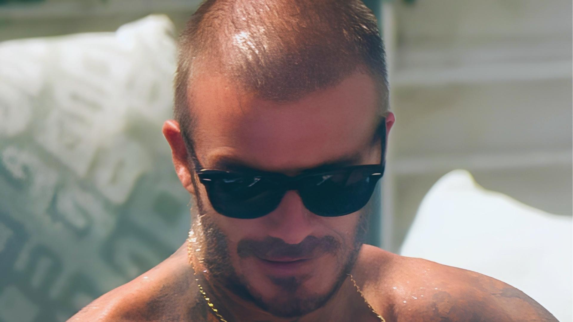 Close-up of shirtless David Beckham outdoors with sunglasses, showing noticeable thinning on crown and frontal area.