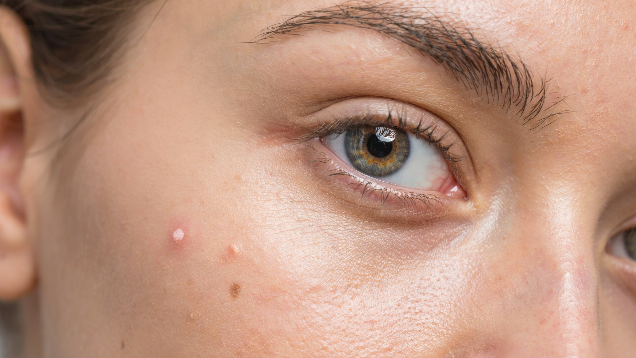 close up skin with spot concealer applied under eyes and small imperfections blended seamlessly maintaining natural texture and lightweight makeup appearance.