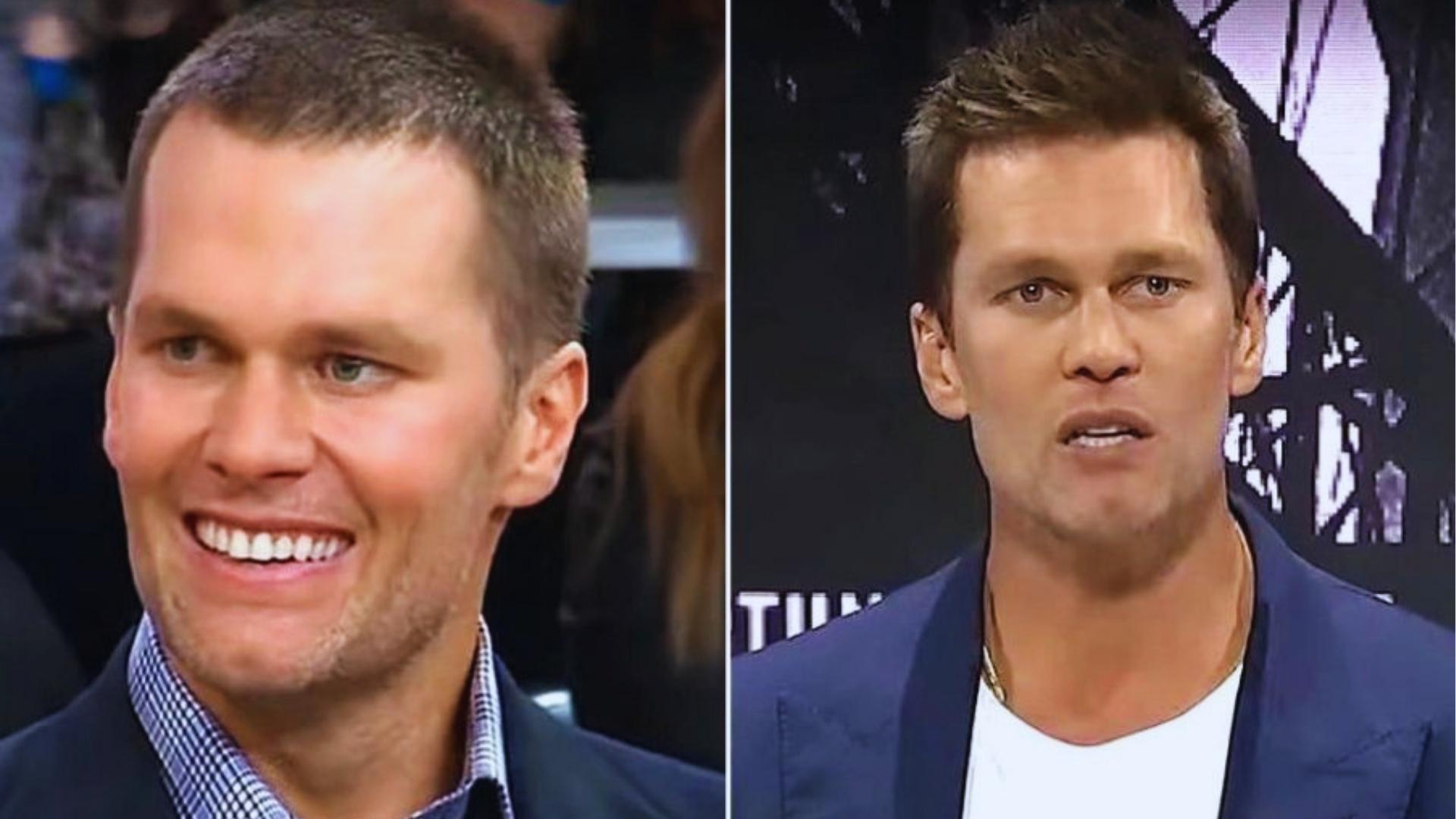 Side by side of Tom Brady buzz cut vs textured longer hairstyle showing hairline change.